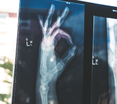 invitiation thumbnail